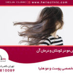 علت ریزش مو در کودکان و درمان آن