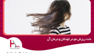 علت ریزش مو در کودکان و درمان آن