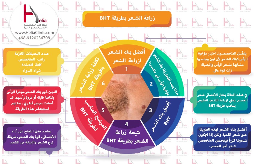 مخطط دليل زراعة الشعر بطريقة BHT