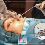 معرفی داروهای مسکن بعد از جراحی بینی