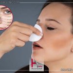 سنگینی بینی بعد از عمل بینی