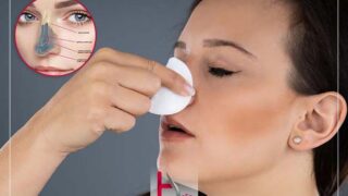 سنگینی بینی بعد از عمل بینی