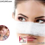 حالت تهوع از بعد عمل بینی