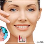 چاق شدن صورت بعد از جراحی بینی