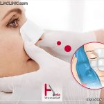 مراقبت پوستی بعد از جراحی بینی