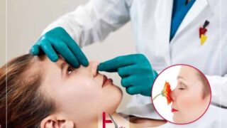 حس بویایی بعد از عمل بینی