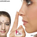 کوچک کردن سوراخ بینی با جراحی بینی