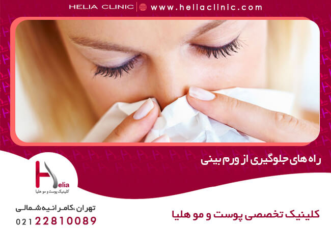 راه های جلوگیری از ورم بینی