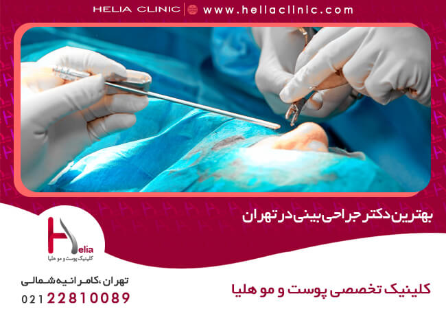 بهترین دکتر جراحی بینی در تهران