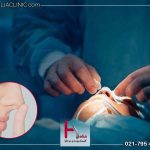 جدیدترین روش عمل بینی