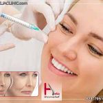 تزریق بوتاکس به گونه