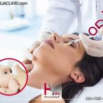 تزریق بوتاکس در دوران بارداری