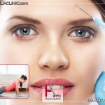 ورزش بعد از تزریق بوتاکس