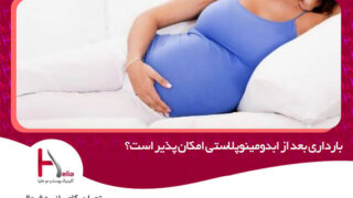 بارداری بعد از ابدومینوپلاستی