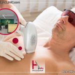 بهترین کلینیک و مرکز لیزر موهای زائد