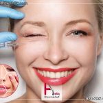 مراقبت های قبل از تزریق بوتاکس
