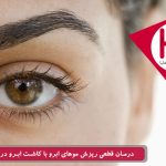درمان قطعی ریزش موهای ابرو با کاشت ابرو در کلینیک هلیا