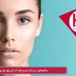 راهنمای درمان ورم بعد از تزریق چربی