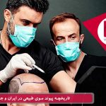 تاریخچه پیوند موی طبیعی در ایران و جهان