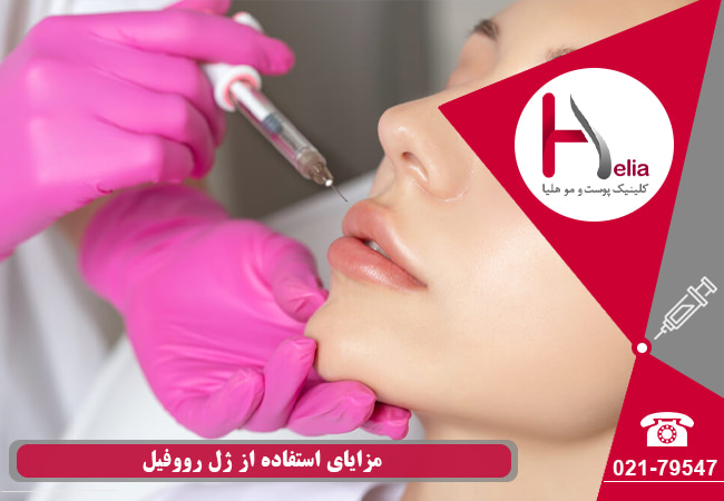مزایای استفاده از ژل رووفیل