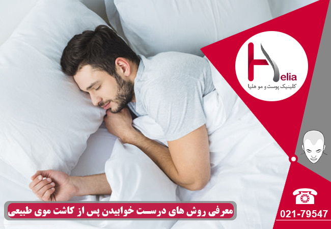روش های درست خوابیدن بعد از پیوند مو
