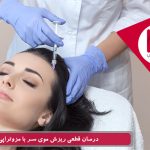 تزریق مزوتراپی به پوست سر
