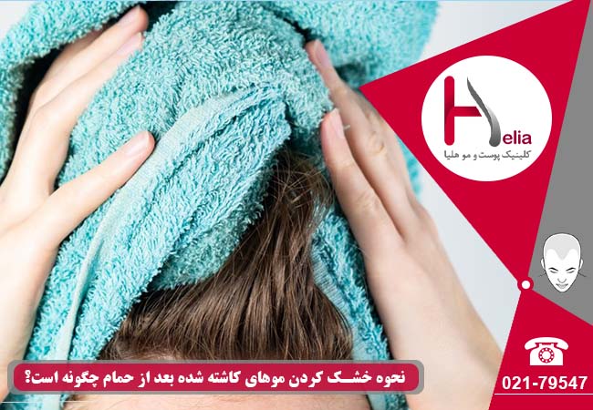 چگونه موهای کاشته شده را بعد از حمام خشک کنیم؟