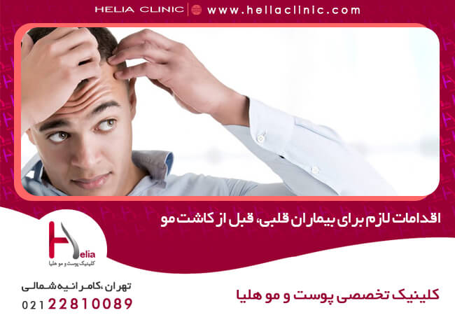 Necessary measures for heart patients before hair transplantation