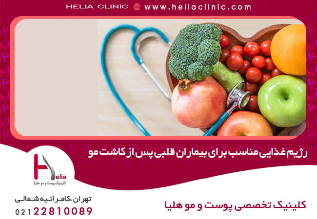 Suitable diet for heart patients after hair transplantation