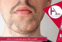 دلایل و درمان ریزش موی صورت در مردان