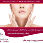 کاهش چین و چروک با اندولیفت صورت