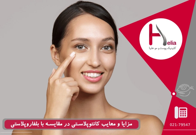 مزایا و معایب کانتوپلاستی در مقایسه با بلفاروپلاستی