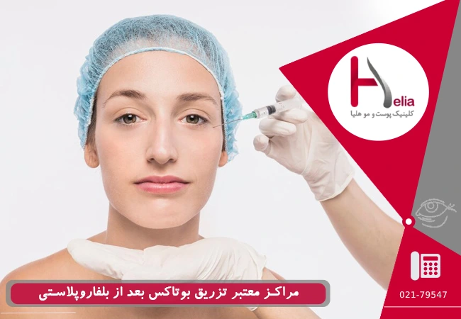 مراکز معتبر تزریق بوتاکس بعد از بلفاروپلاستی