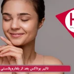 بوتاکس بعد از بلفاروپلاستی