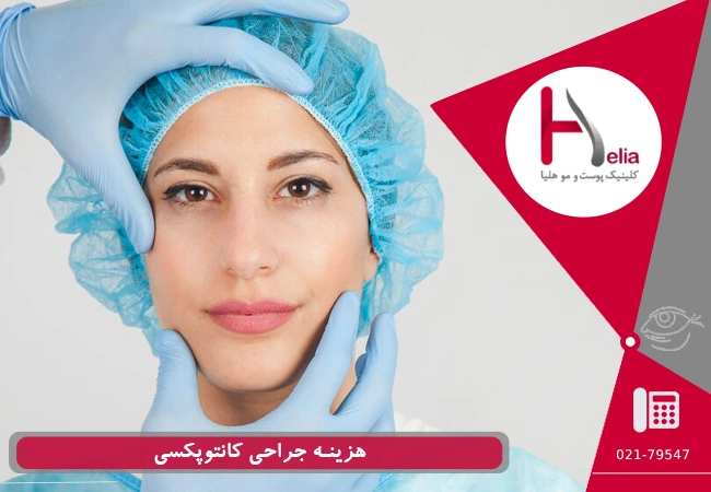 هزینه جراحی کانتوپکسی