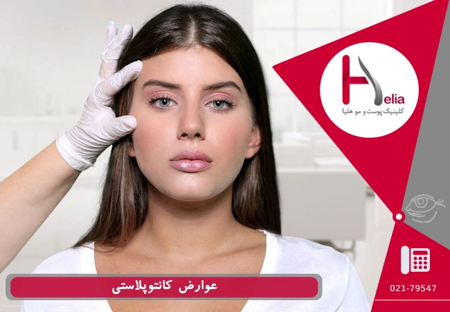 عوارض کانتوپلاستی