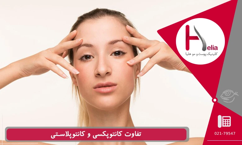 تفاوت کانتوپکسی و کانتوپلاستی