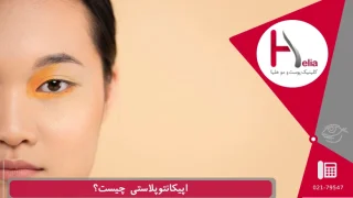 اپیکانتوپلاستی