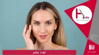 روش های لیفت چشم