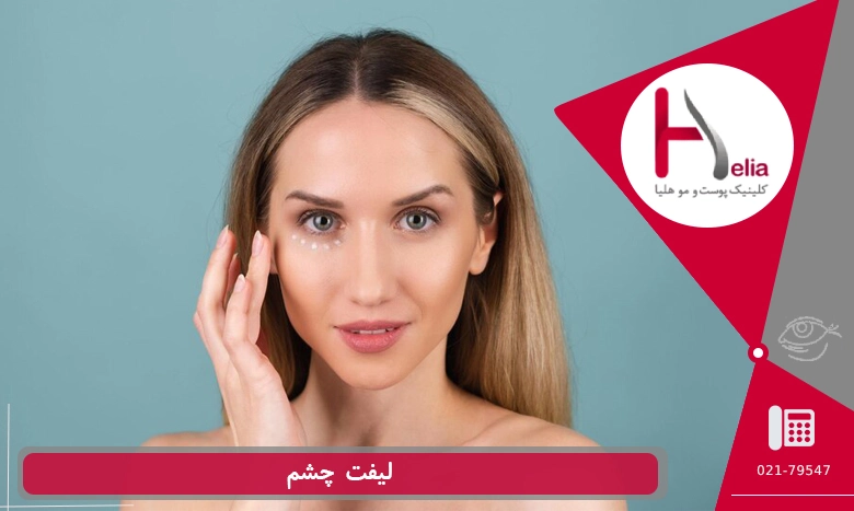 روش های لیفت چشم