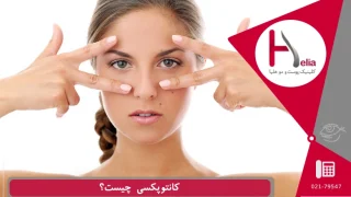 کانتوپکسی جوانسازی پلک چشم