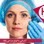 جدیدترین روش های جراحی پلک در ایران