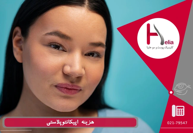 هزینه اپیکانتوپلاستی