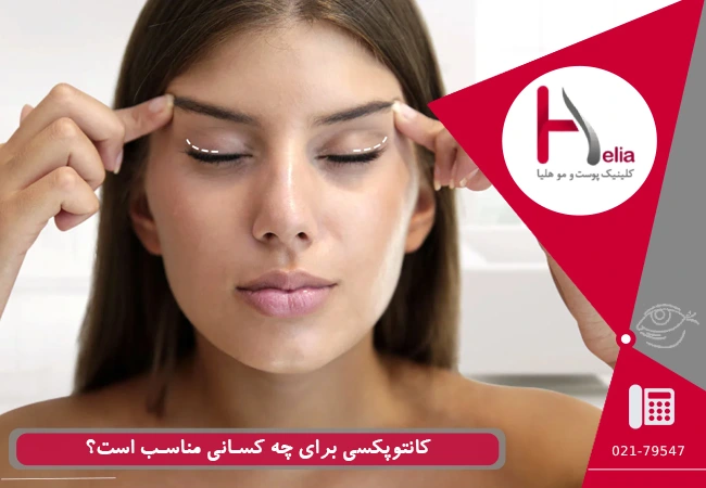 کانتوپکسی برای چه کسانی مناسب است؟