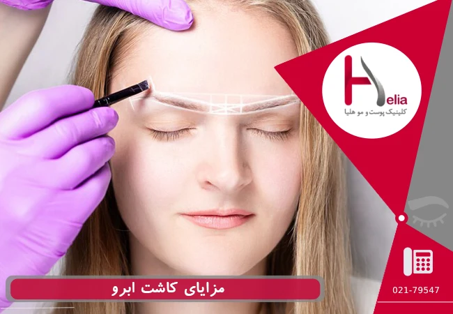 مزایای کاشت ابرو