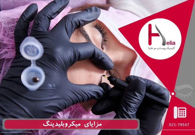 مزایای میکروبلیدینگ