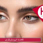 کاشت ابرو بازیگران