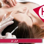 فیلر مو