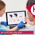 انواع روش‌های کاشت مو